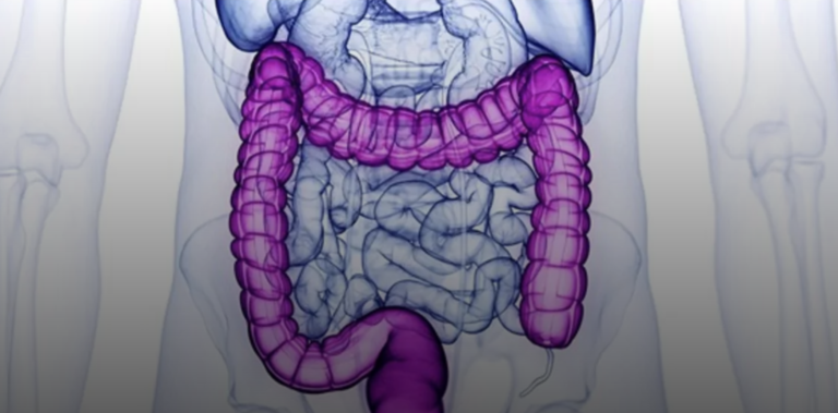 C-S/ El escudo invisible: cómo tus bacterias protegen tu colon