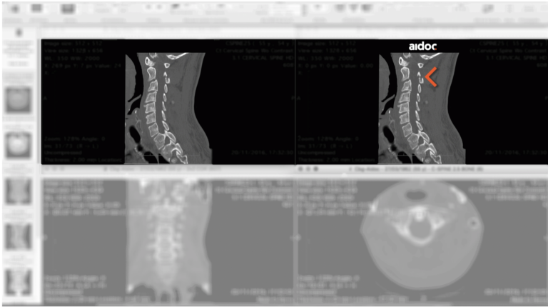 El futuro de la radiolobía también sale de Israel